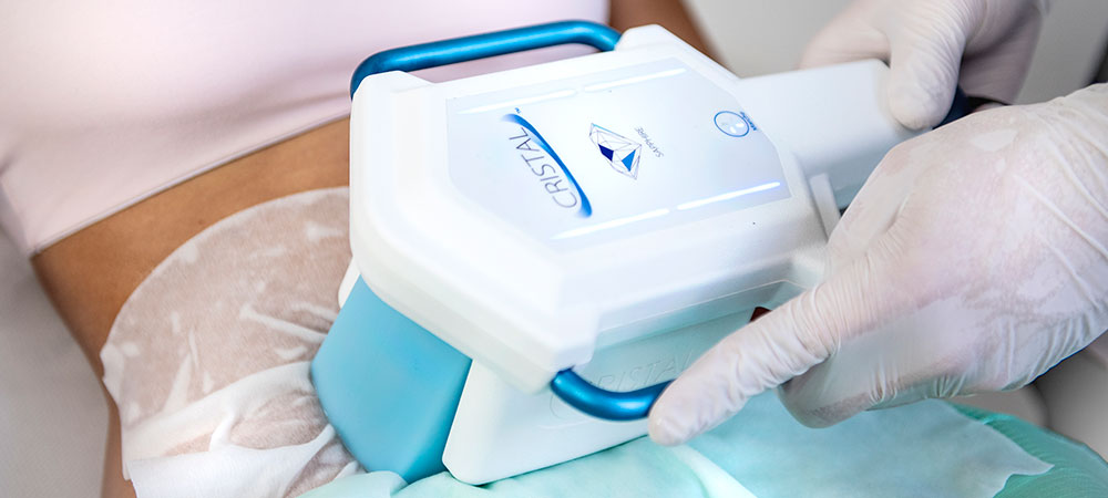 Sicherheit bei der Kryolipolyse Behandlung
