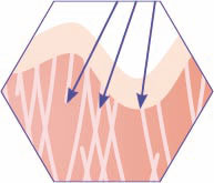 CRISTAL Skin Emission von Radiofrequenzwellen 